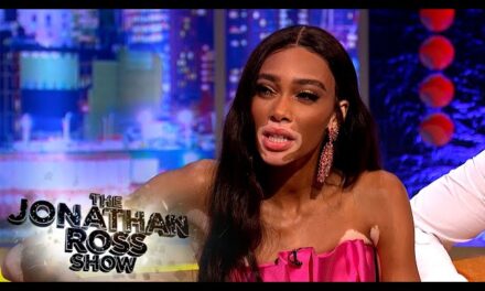 Model Winnie Harlow Opens Up About Her Journey in the Modeling Industry on ‘The Jonathan Ross Show’